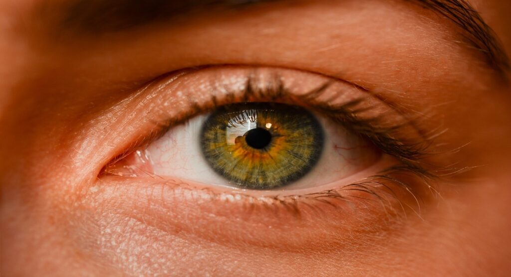 Natural Remedies for Dark Circles Under your Eyes