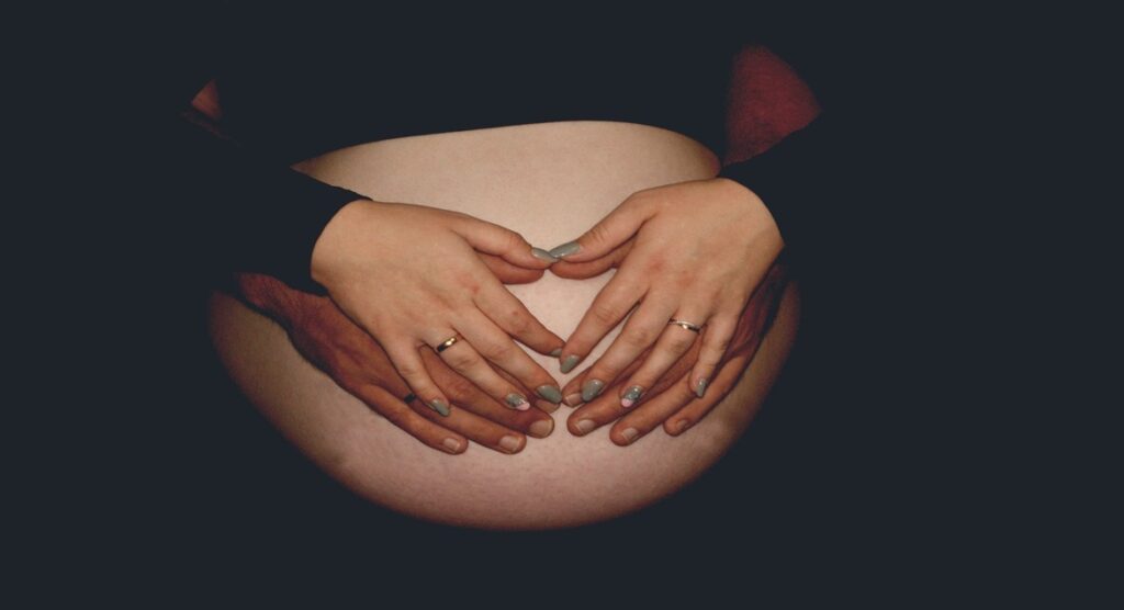 Stretch Mark Treatment